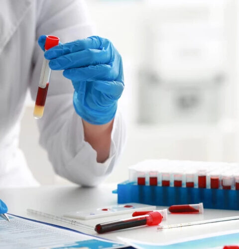 Анализы по возрасту: что и когда необходимо проверять?