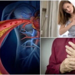 "Пища, которая лечит: секреты снижения 'вредного' холестерина"