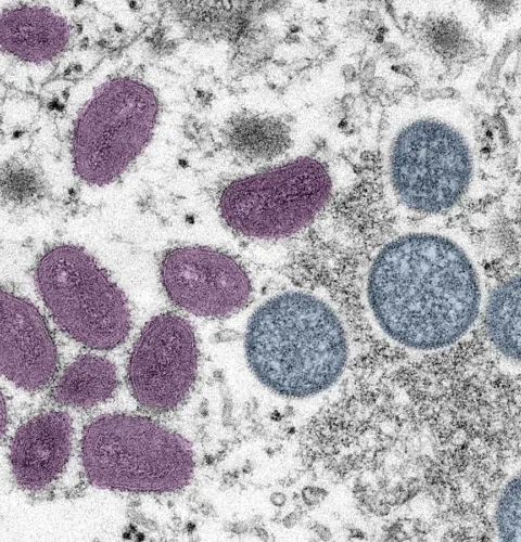 В Румынии впервые зафиксирован вирус POX