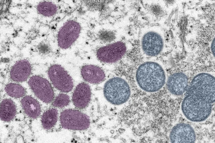 В Румынии впервые зафиксирован вирус POX