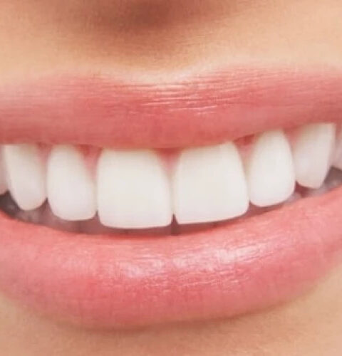 ПАГУБНЫЕ ПРИВЫЧКИ, УБИВАЮЩИЕ ЗУБЫ