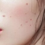 Почему обладатели родинок доживают до глубокой старости?