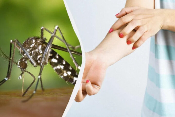 В Украине выявлен опасный тигровый комар, несущий угрозу для здоровья населения