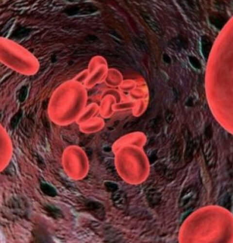 Авокадо как продукт для снижения уровня холестерина и очищения сосудов