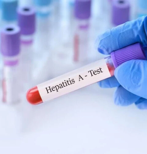 В Румынии зафиксированы случаи гепатита А в семи населённых пунктах