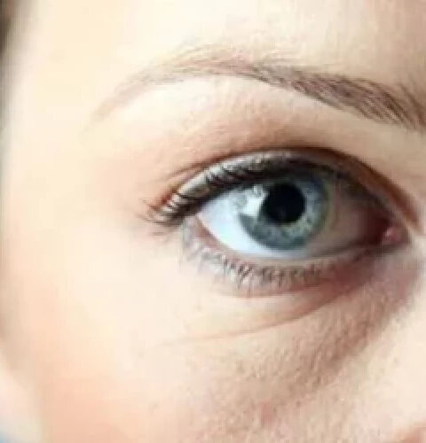 Цвет кругов под глазами и его связь с состоянием здоровья