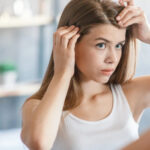 Эффективные природные средства для борьбы с перхотью