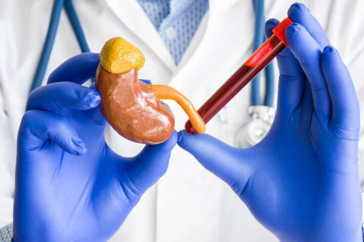 Как естественным образом снизить уровень кортизола в организме