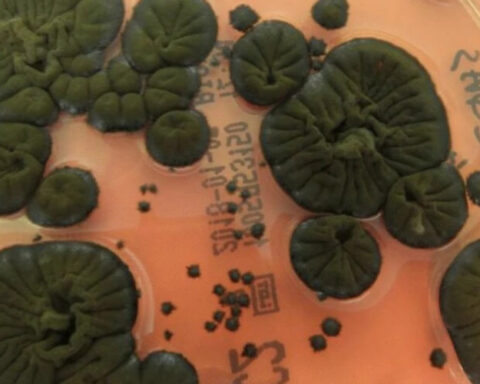 Учёные обнаружили уникальный гриб в Чернобыле, способный использовать ионизирующее излучение