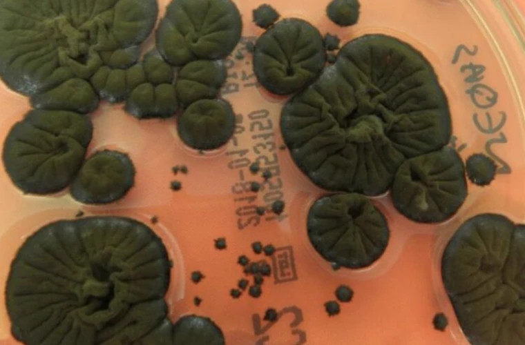 Учёные обнаружили уникальный гриб в Чернобыле, способный использовать ионизирующее излучение