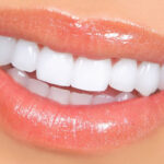 Забота о здоровье зубов: советы для поддержания белизны и красоты улыбки