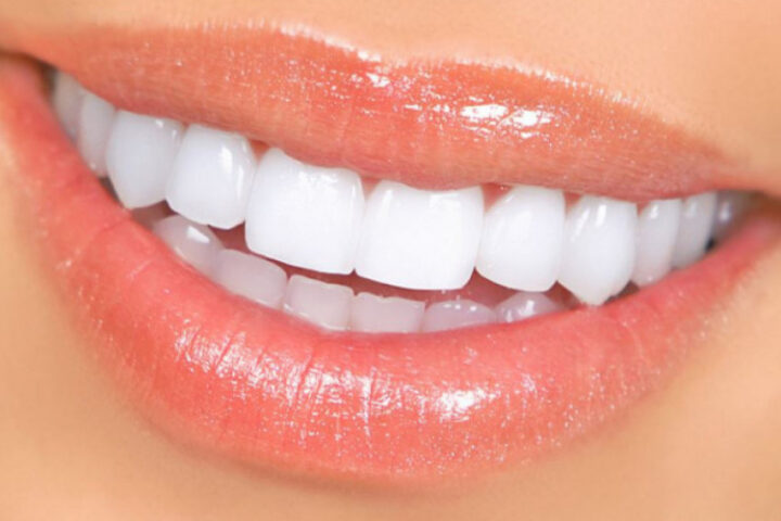 Забота о здоровье зубов: советы для поддержания белизны и красоты улыбки