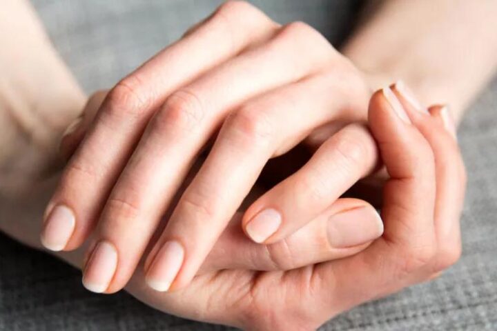 Белые пятна на ногтях: причины, виды и методы профилактики