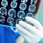 Лечение пациента с инсультом стоит 40 тысяч леев: сколько пациентов получили помощь в 2026 году?