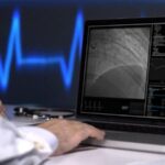 Лечение инфаркта миокарда стоит до 100 тысяч леев, для застрахованных пациентов бесплатное
